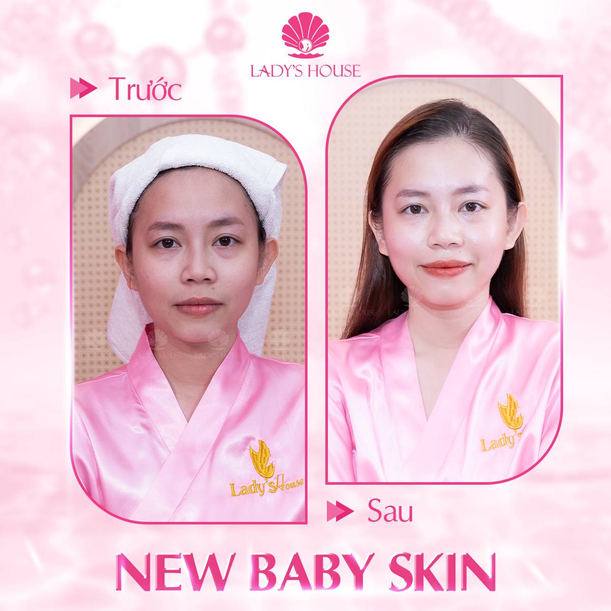 Baby Skin trắng hồng