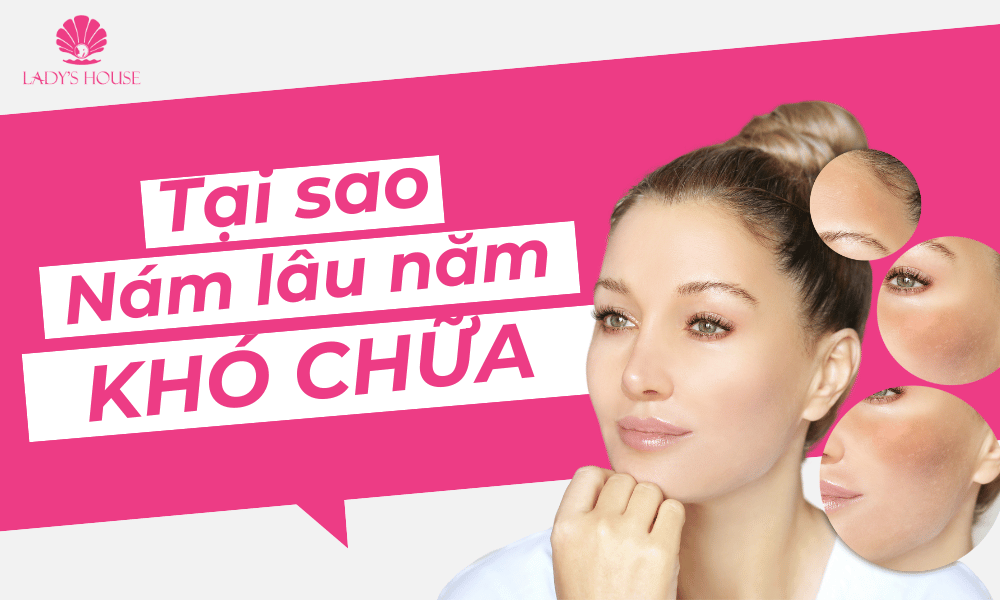 Tại sao nám lâu năm lại khó chữa? Nám tái phát do đâu?