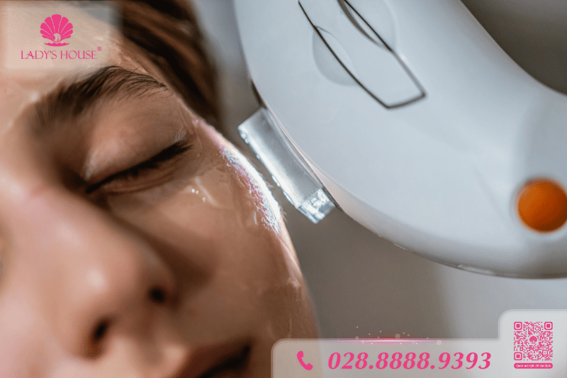 điều trị mụn bằng IPL tiên tiến