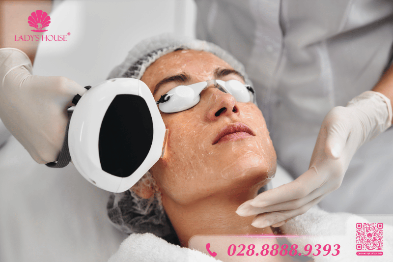 sử dụng ánh sáng IPL để điều trị mụn